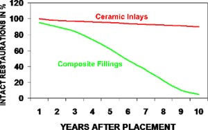 ADVANTAGES OF CERAMIC INLAYS