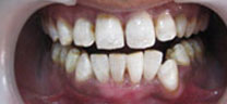 Cosmetic Dentistry - After