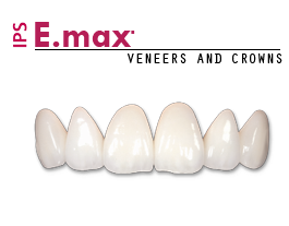 Emax crowns - veneers near me