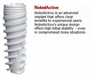 Nobel Biocare – Active Dental Implants