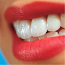 Root Canal Treatment