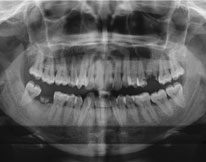 Dental Radiology - Digital Panoramic X-Ray