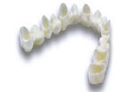 Metal Free Crowns & Bridges