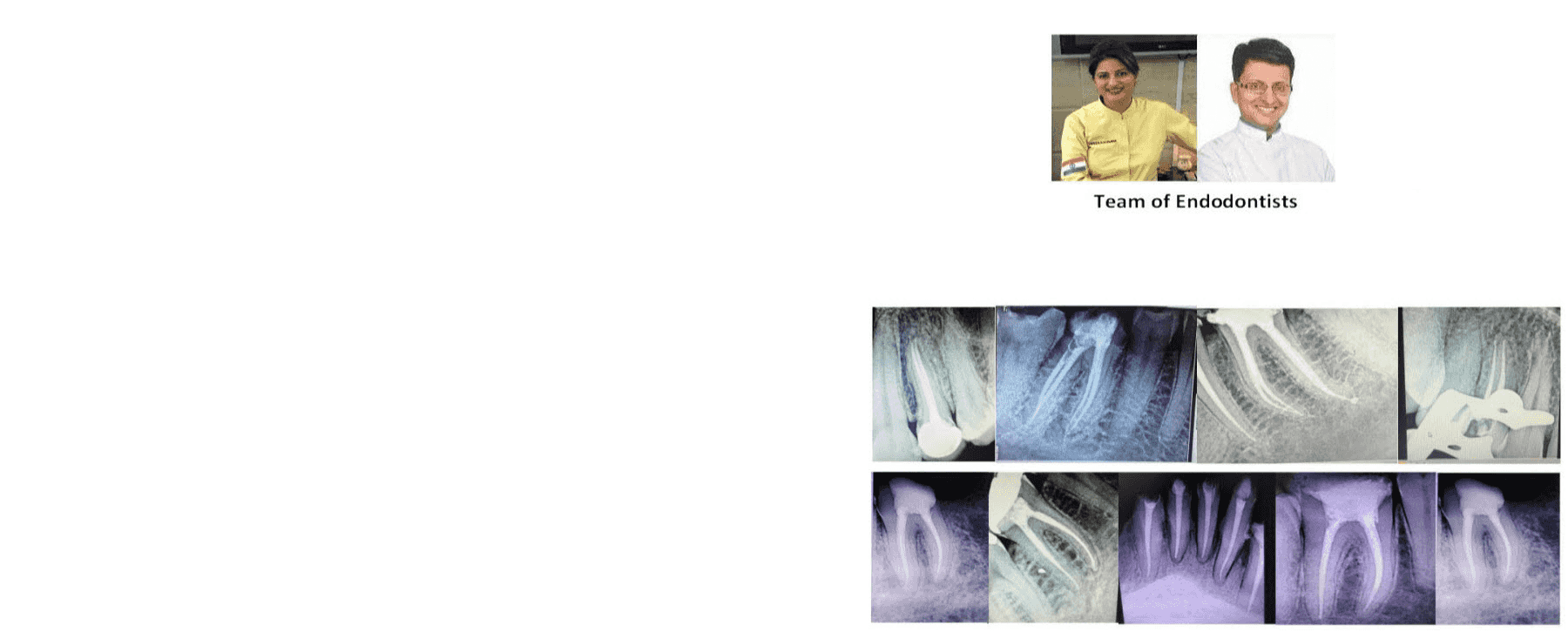 Root Canal Awareness Programme