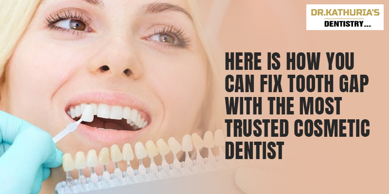 Here is how you can fix tooth gap with the most trusted cosmetic dentist