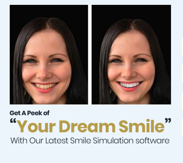 Get a peek of your dream smile with our latest smile simulation software