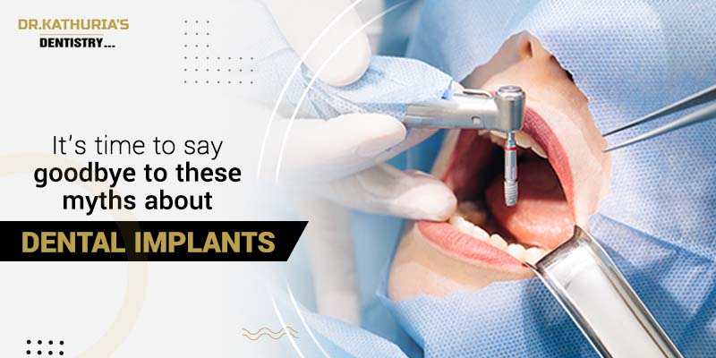 It's time to say goodbye to these myths about dental implants