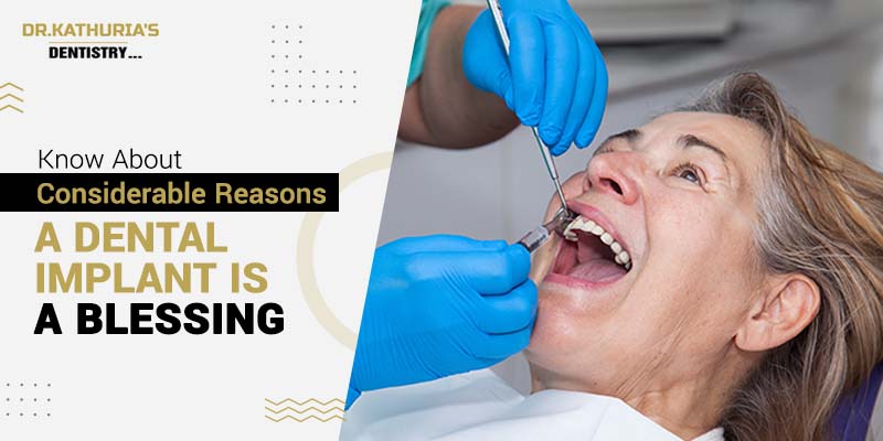 Know About Considerable Reasons a Dental Implant is a Blessing.