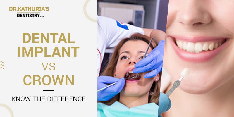 Dental implant vs crown: know the difference