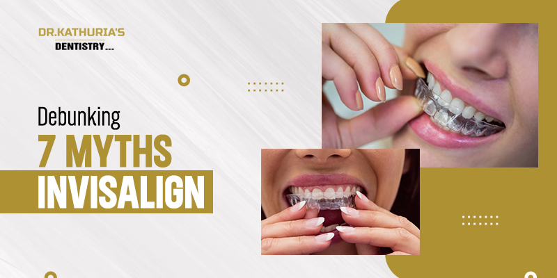 Debunking 7 Myths About Invisalign