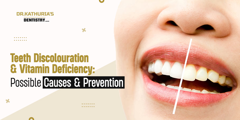 Teeth Discolouration & Vitamin Deficiency