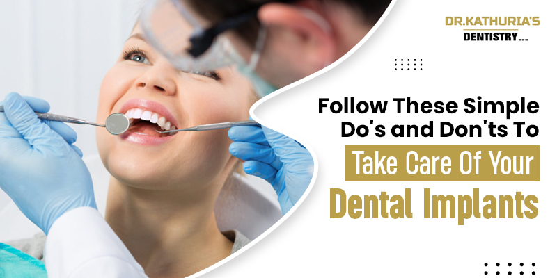 full dental implants in South Delhi