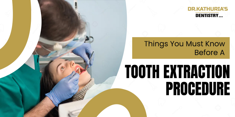 best dentist for tooth extraction in delhi