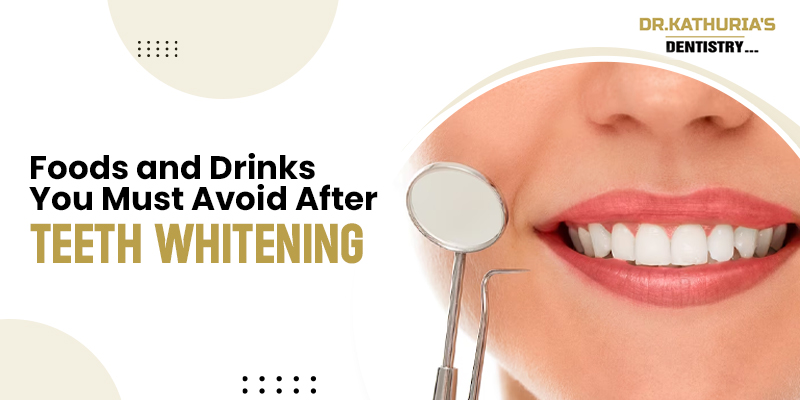 Foods and Drinks You Must Avoid After Teeth Whitening