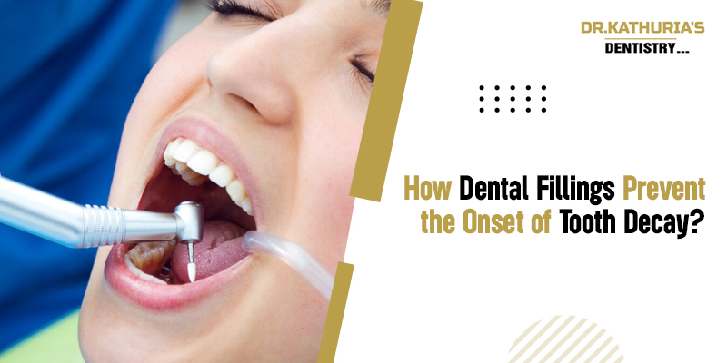 How Dental Fillings Prevent the Onset of Tooth Decay?