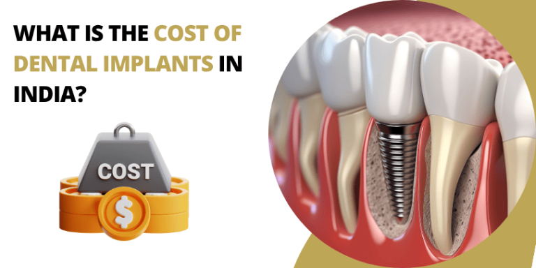 What Is the Cost of Dental Implants in India?