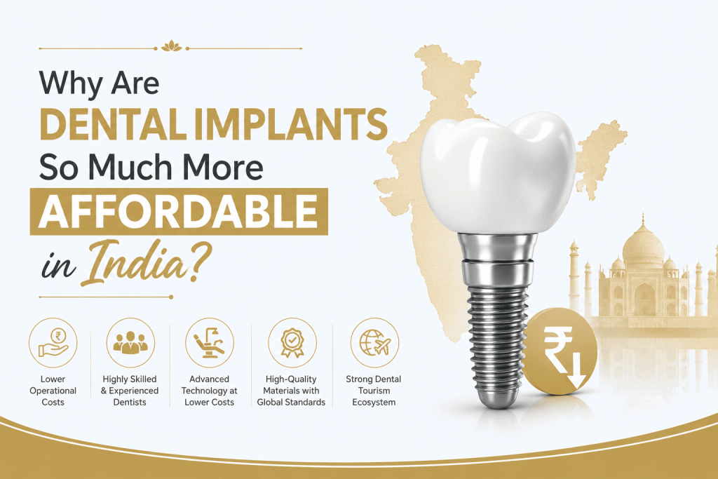 Why Are Dental Implants So Much More Affordable in India?
