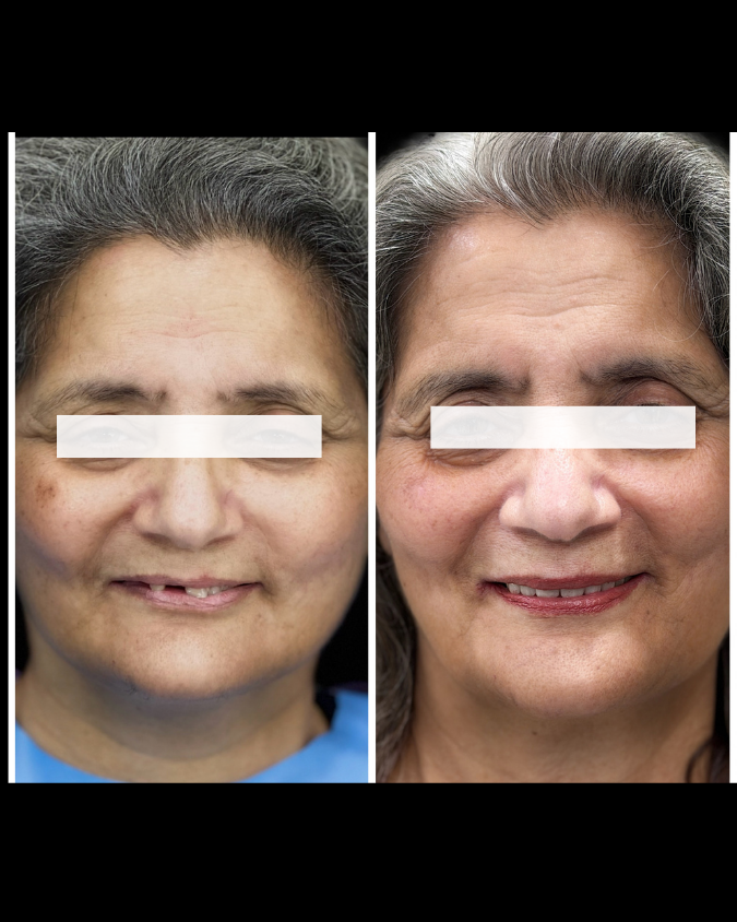 Case 11